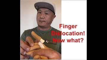 Finger Dislocation reduction  | Sports Medicine | Athletic Training | Hand doctor