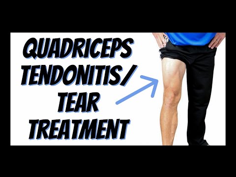 וִידֵאוֹ: 3 דרכים לטיפול בדלקת גידים Quadriceps