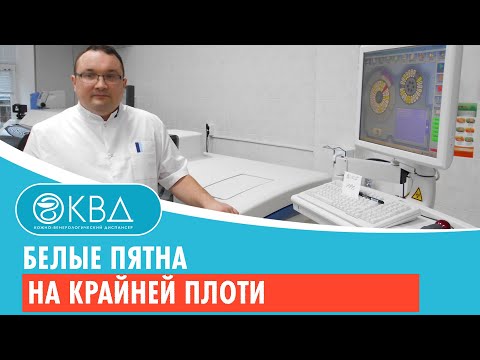 Видео: Белые пятна на крайней плоти: причины, другие симптомы, лечение