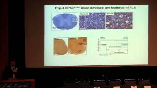 2011-"Ask the Experts-'Living with ALS" at UCLA--Dr. Robert Baloh