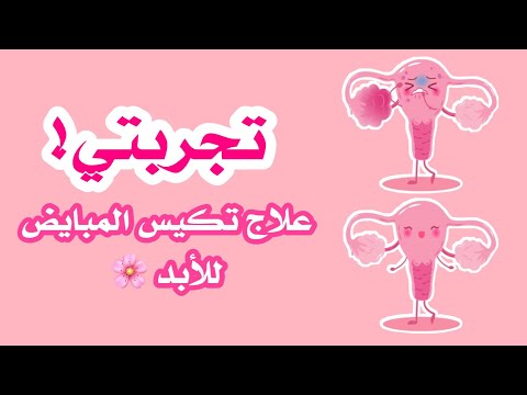 كيف تخلصت من تكيس المبايض للأبد وبدون علاجات وأعشاب وخلطات 😍❤️ | تجربتي الشخصية في علاج التكيس