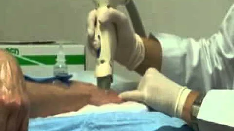 Dr Marina Buckley demonstrates the use of the thermage system - MilfordMD.com