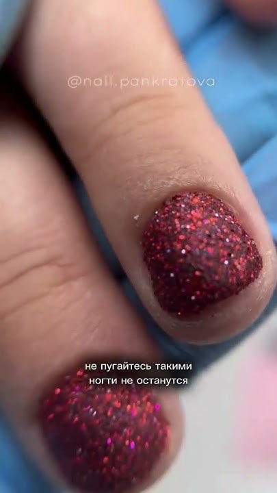 аллергия на гель-лак / нельзя делать покрытие ногтей / титановые ногти ...