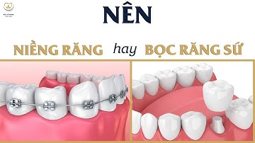 Nên Niềng Răng Hay Bọc Răng Sứ Thẩm Mỹ | Bác sĩ Trung Long Biên