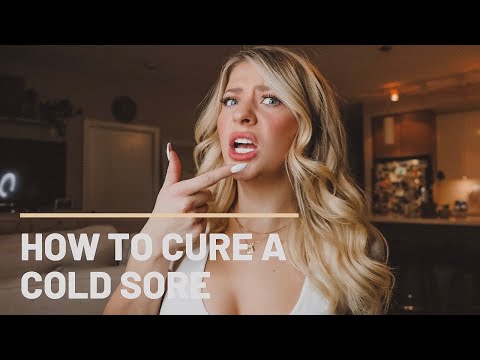 HOW TO: Cure A Cold Sore | NO SCABBING