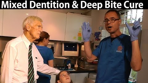 Orthotropics Case Assessment for Deep Bite Correction During Mixed Dentition Period by Dr Mike Mew