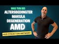 Was tun bei Altersbedingter Makula Degeneration AMD