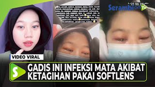 Ketagihan Pakai Softlens sampai Infeksi, Mata Seorang Gadis Dikorek Sampai Alami Buta Sementara