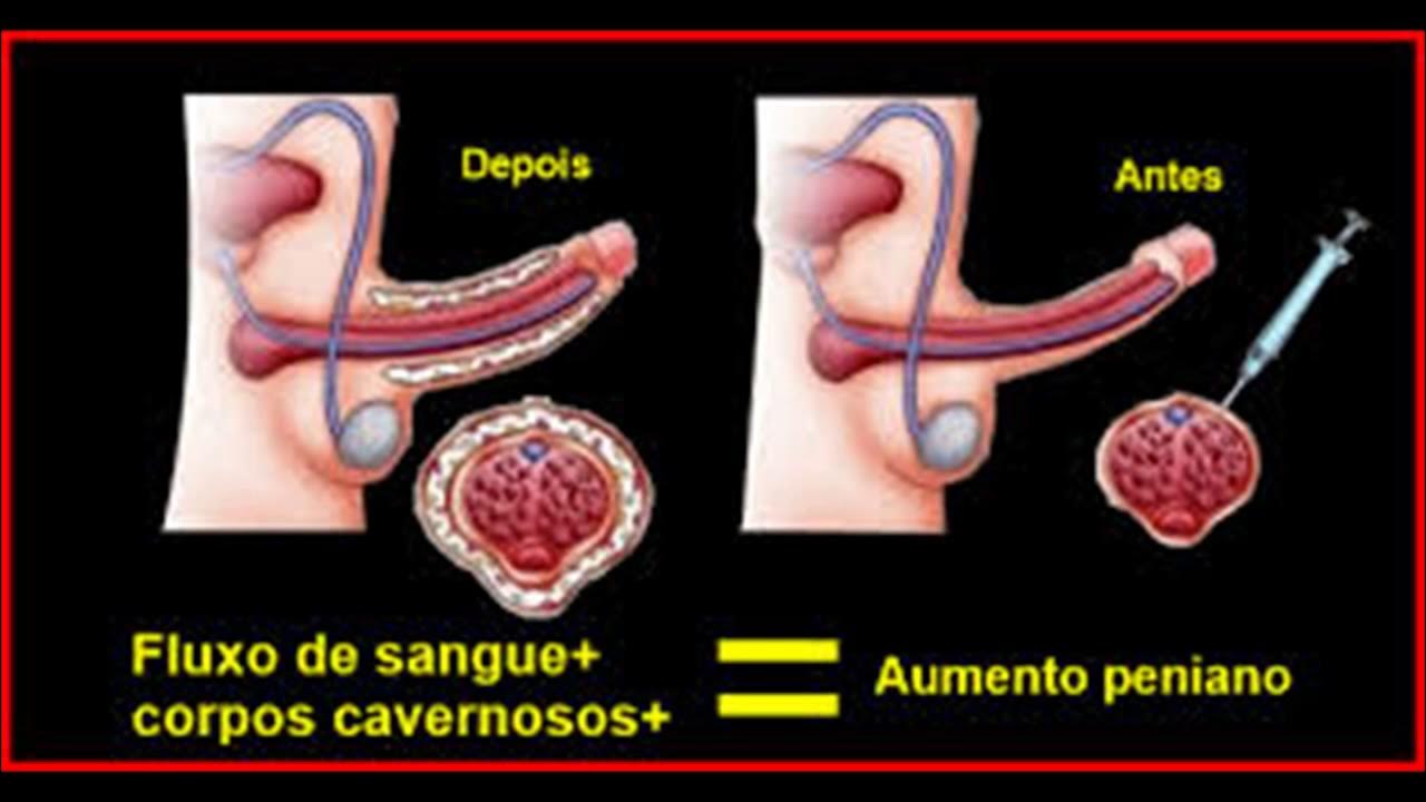 Como depurar el higado de forma natural