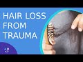 Telogen Effluvium: Hair Loss After a Traumatic Event