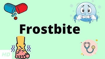 Frostbite, Causes, Signs and Symptoms, DIagnosis and Treatment.