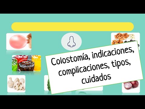 Video: ¿Cuáles son las indicaciones de la colostomía?