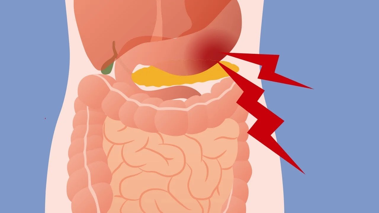 how-to-get-rid-of-stomach-noise-and-gas-youtube