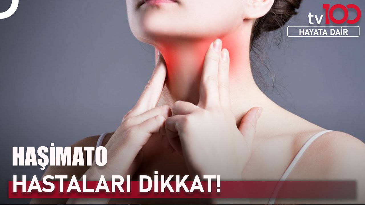 Haşimato Hastaları Nasıl Beslenmeli? | Hayata Dair