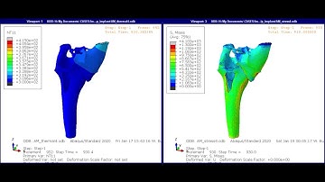 Using Abaqus to simulate additive manufacturing – Printing an optimized hip implant