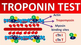 Troponin test and it's significance