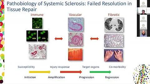Endocannabinoid System & Ssc Corbus Pharmaceutical...