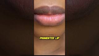 If you have a  normal skin problem #bummpy skin #dark circle #dark lip#uneventone#pigmanted lips
