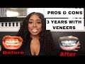 THE TRUTH ABOUT VENEERS, 3 YEAR UPDATE, DR. PEREZ NYC