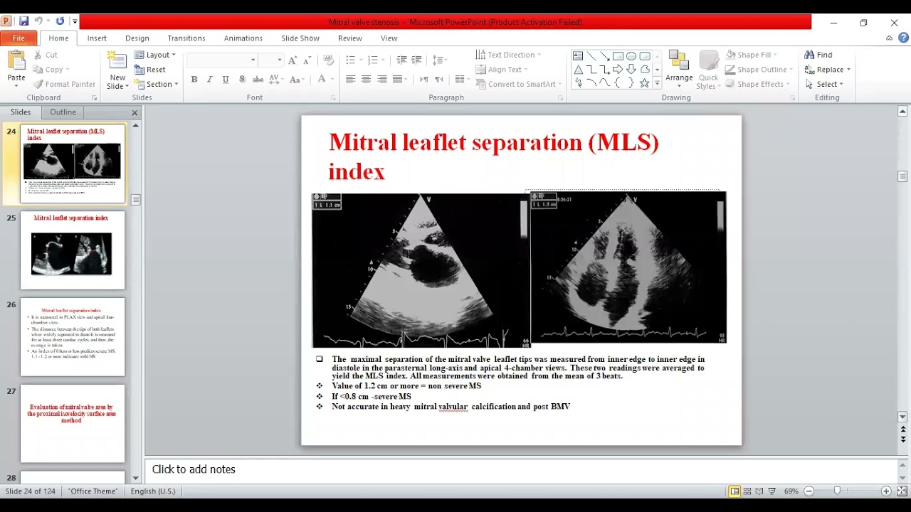4- Echo assessment of MS - Prof. Noha Hassanein