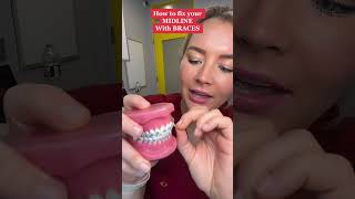 Send to your friends and comment what pattern you want next! #braces #rubberbandsforbraces