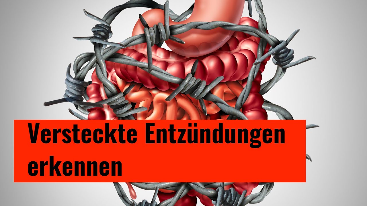 Stille - versteckte - Entzündungen machen uns krank - was können wir ...