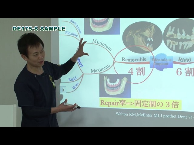 無歯顎多数歯欠損症例におけるインプラント治療 - YouTube