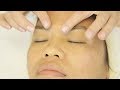 Skin Analysis And Scarring Treatment With Thuy Pt 1