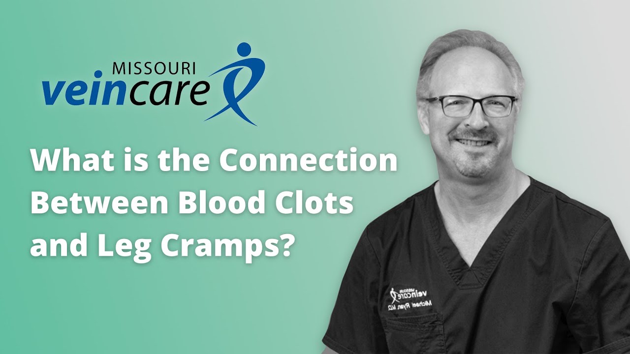 What is the Connection Between Blood Clots and Leg Cramps? YouTube