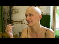 У Лизы алопеция. ТЫ НЕ ЗНАЕШЬ, КАК НАС МНОГО. ПРОСТО МЫ В ПАРИКАХ.  #alopecia