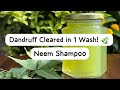 DIY Neem Shampoo for Dandruff & Hair Fall | Natural Foaming Herbal Cleanser #neem #trending #diy