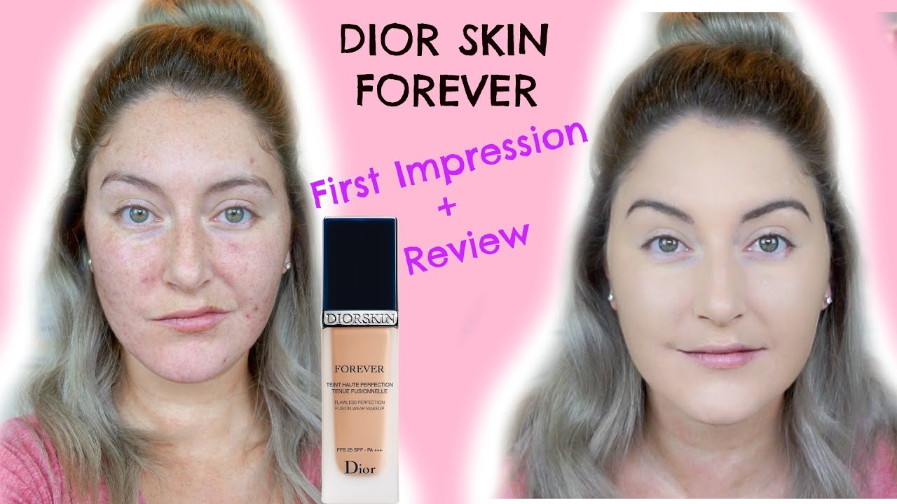 dior foundation for acne prone skin