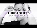 What is the REAL truth about Threadlifts? No spin here!