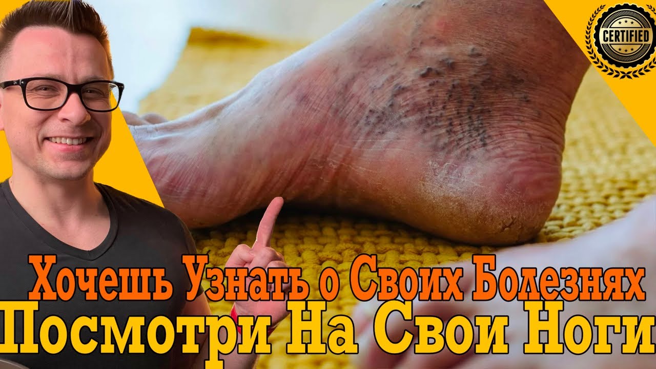 Посмотри на свои ноги прямо сейчас - расскажут о болезнях!