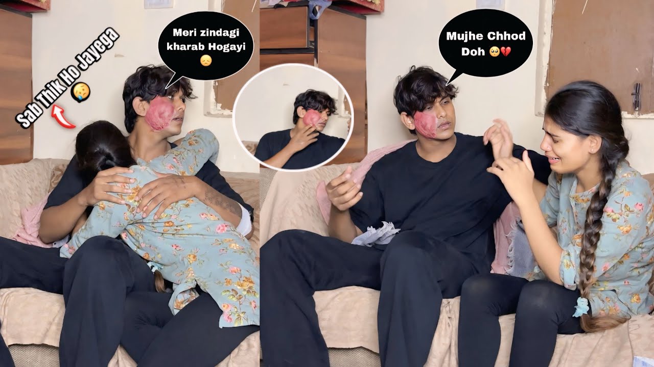 Face Burn Prank On Girlfriend || ￼ loyalty test 🥺 