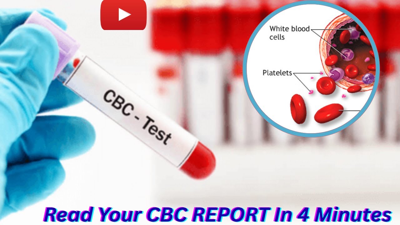 Simple Cbc “CBC Test Report Explained | RBC, Hemoglobin, WBC & Platelets in Simple ...