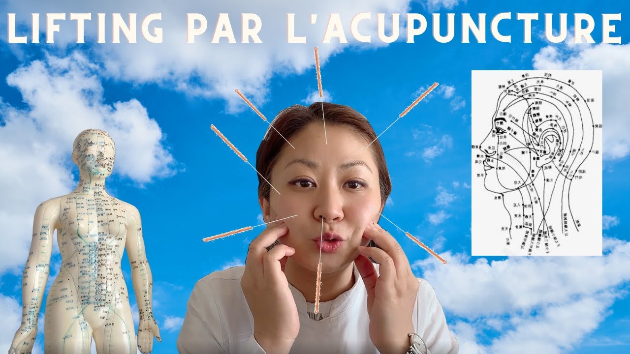 Lifting par l'acupuncture 💉😘
