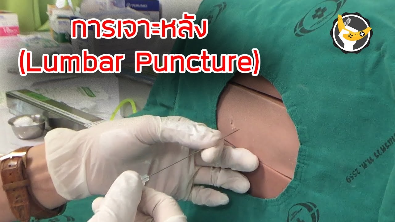 การเจาะหลัง (Lumbar Puncture)