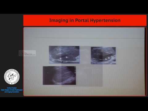 28_Imaging in Portal Hypertension