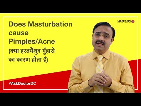 Does Masturbation cause Pimples/Acne (क्या हस्तमैथुन मुँहासे का कारण होता है) | (In HINDI)