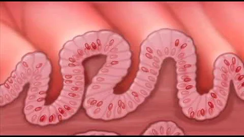 What is short Barrett's esophagus?