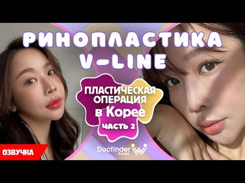 Исправление динного лица и ринопластика/ Chenelle Wen Часть 2 /Пластика в Корее