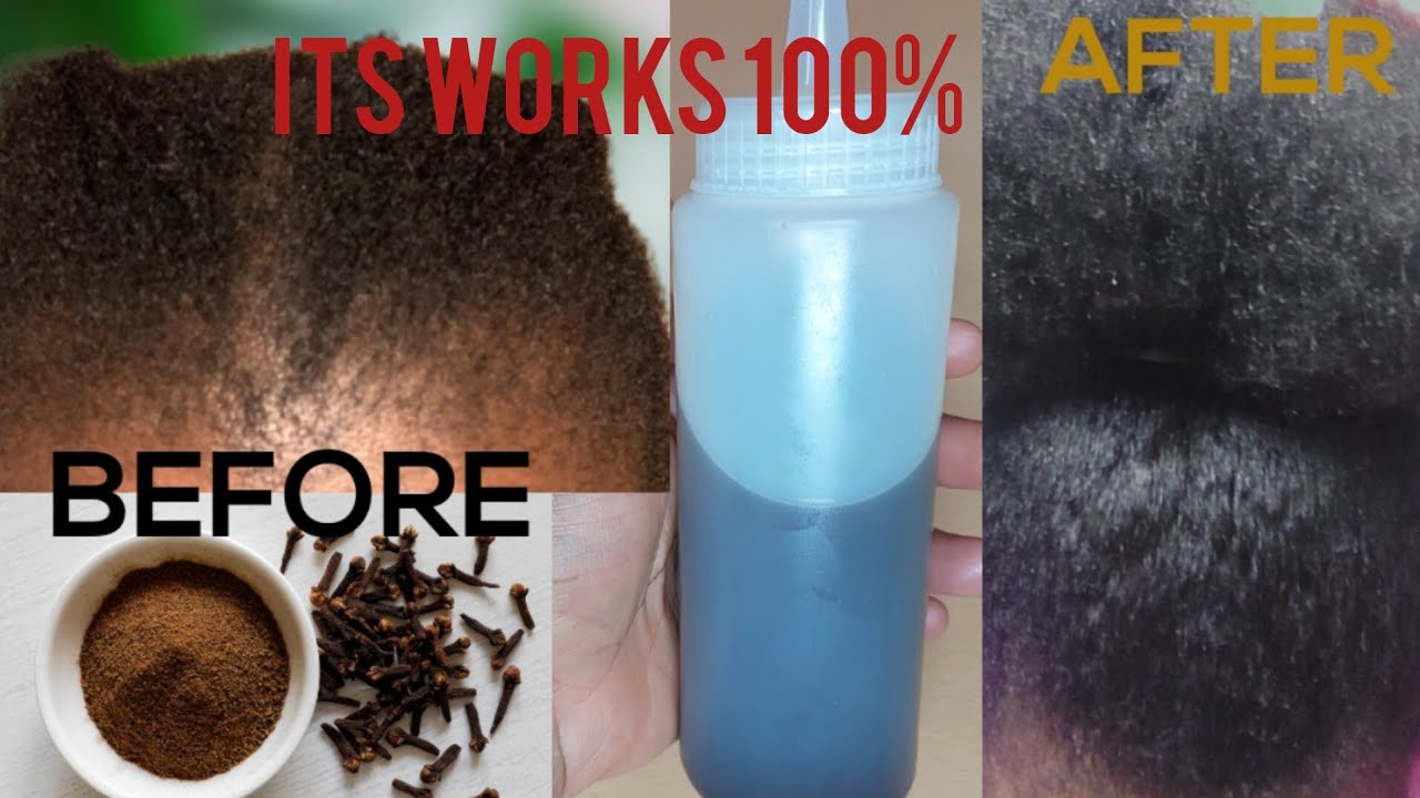 SO POWERFULL!!! How To Make Cloves Oil At Home For An Unstoppable Hair