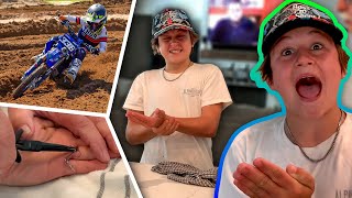 How To Remove A Fishing Hook From Your Hand!!