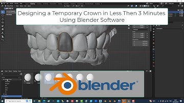 Designing a Temporary Crown Using Blender Software