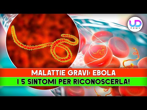Malattie Gravi, Ebola: I 5 Sintomi Per Riconoscerla!