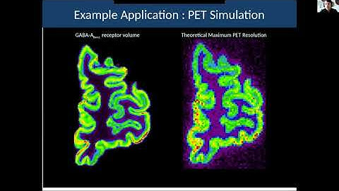 Thomas Funck - Towards an ultra-high resolution 3D neurotransmitter receptor atlas