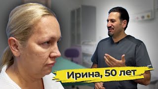 Омоложение лица: Ирина, 50 лет