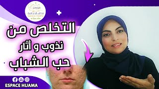 استخدم هذا الزيت و تخلص نهائيا من اثار حب الشباب و ندوب الجلد