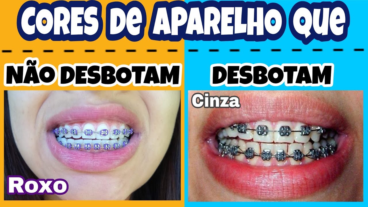 CORES DE APARELHO Que NÃO DESBOTAM e DESBOTAM !!! (Minha opinião e dica) YouTube CORES DE APARELHO Que NÃO DESBOTAM e DESBOTAM !!! (Minha opinião e dica) YouTube